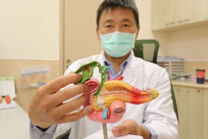 膽結石治療