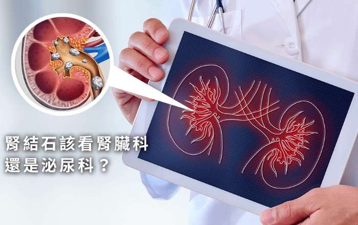 腎結石看什麼科