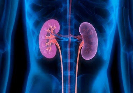 腎結石治療 腎結石治療
