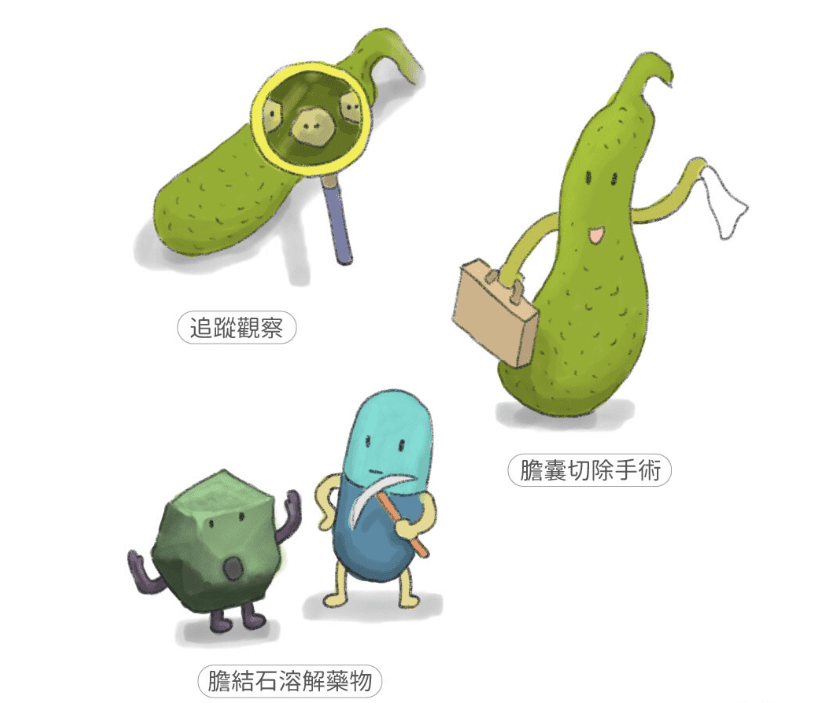 膽結石發生位置 膽結石發生位置