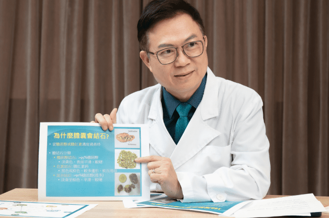 膽結石預防 膽結石預防