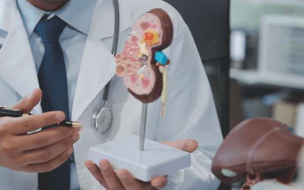 腎結石檢查方式 腎結石檢查方式